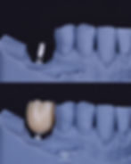 dentist in cancun mexico