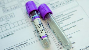 復星醫藥(02196)子公司獲授腫瘤藥Balixafortide中港澳台專利