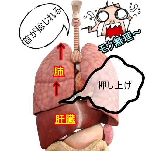 寝違えの原理