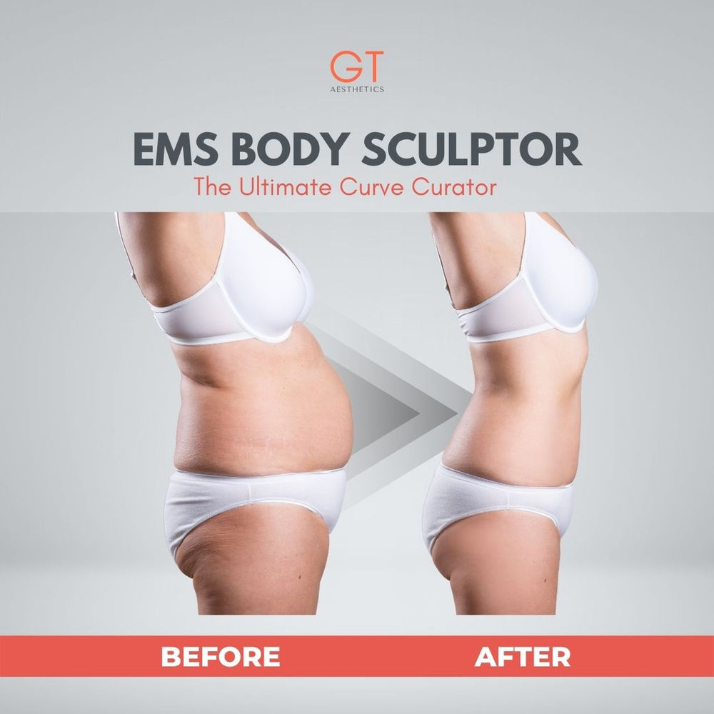 EMS YOUR EFFORTLESS BODY CONTOURING TREATMENT