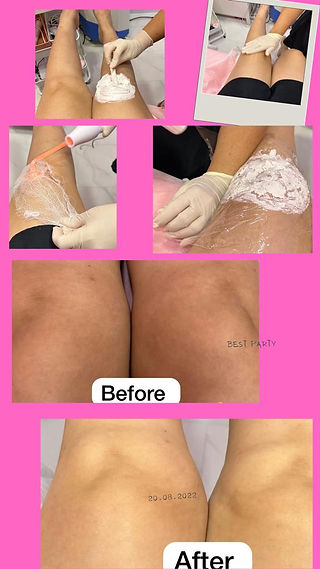 knees whitening singapore