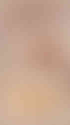 instant whitening singapore