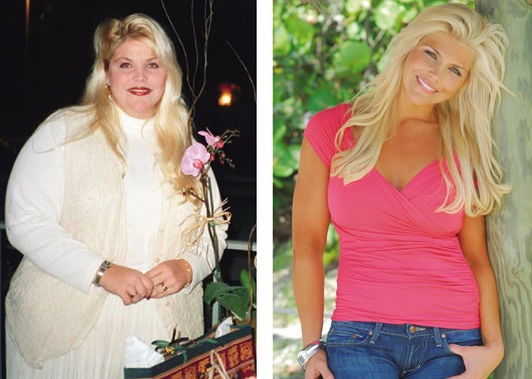 Successful Weight Loss - Before and After