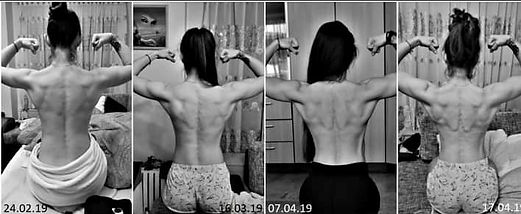 women-shoulder-before-and-after