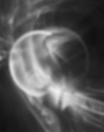 Irradiation #36