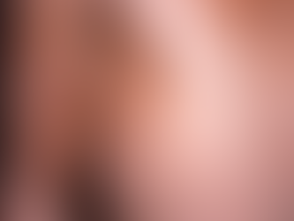 Apenas o Brasil e os EUA registra mais de 10 mil casos de varíola do macaco