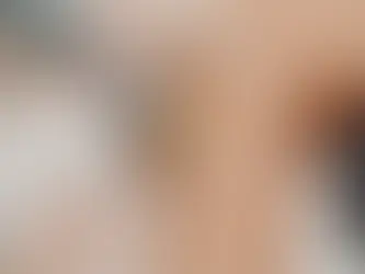 激光脫毛後的保養指南:讓你的肌膚持續光滑