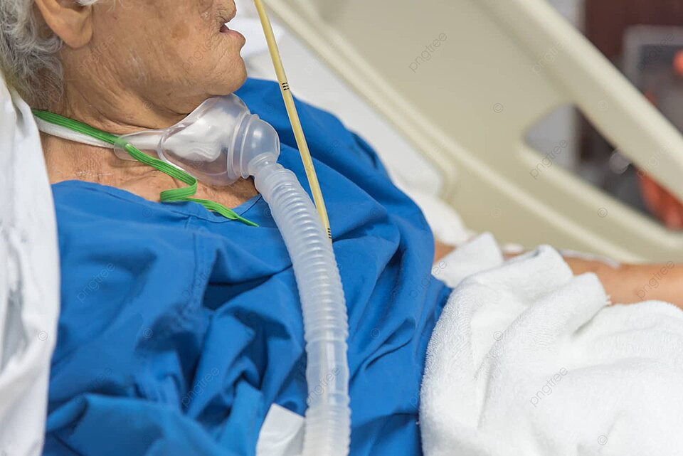 pngtree-patient-do-tracheostomy-and-ventilator-in-hospital-intensive-room-adult-photo-imag