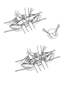 Untitled_Artwork 96.png