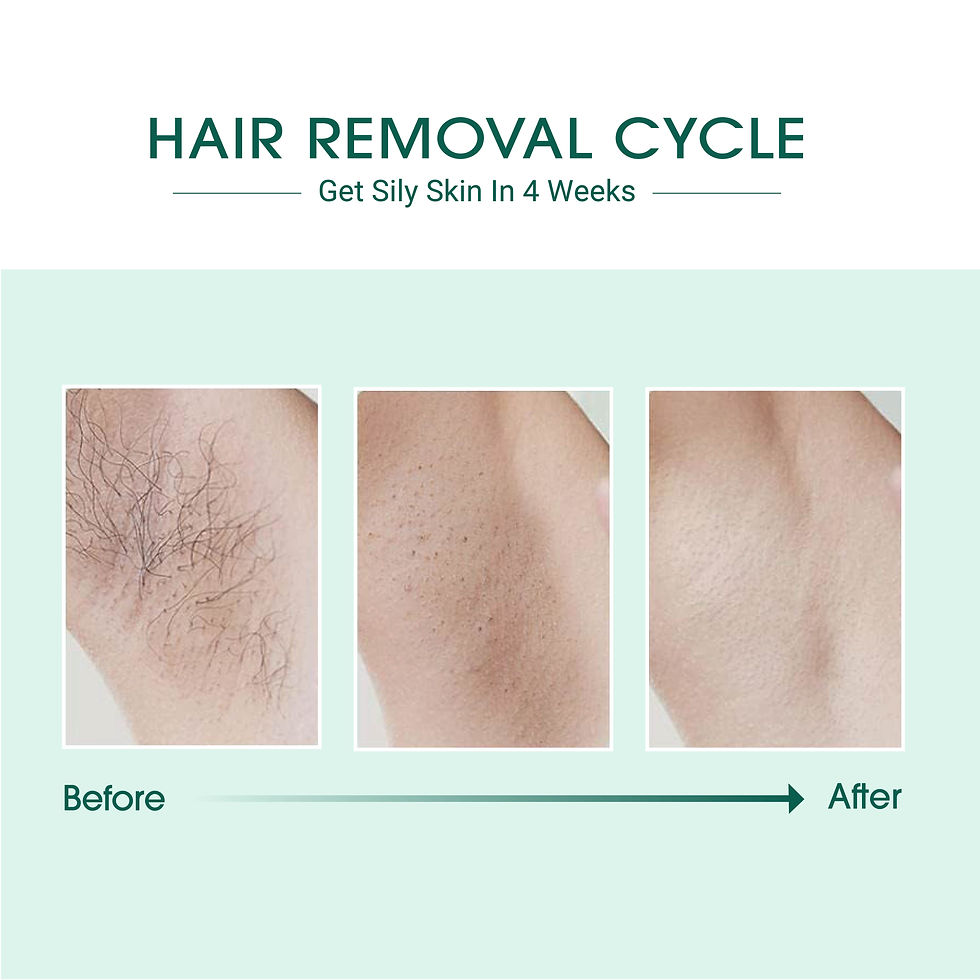 Thumbnail: Laser IPL Hair Removal