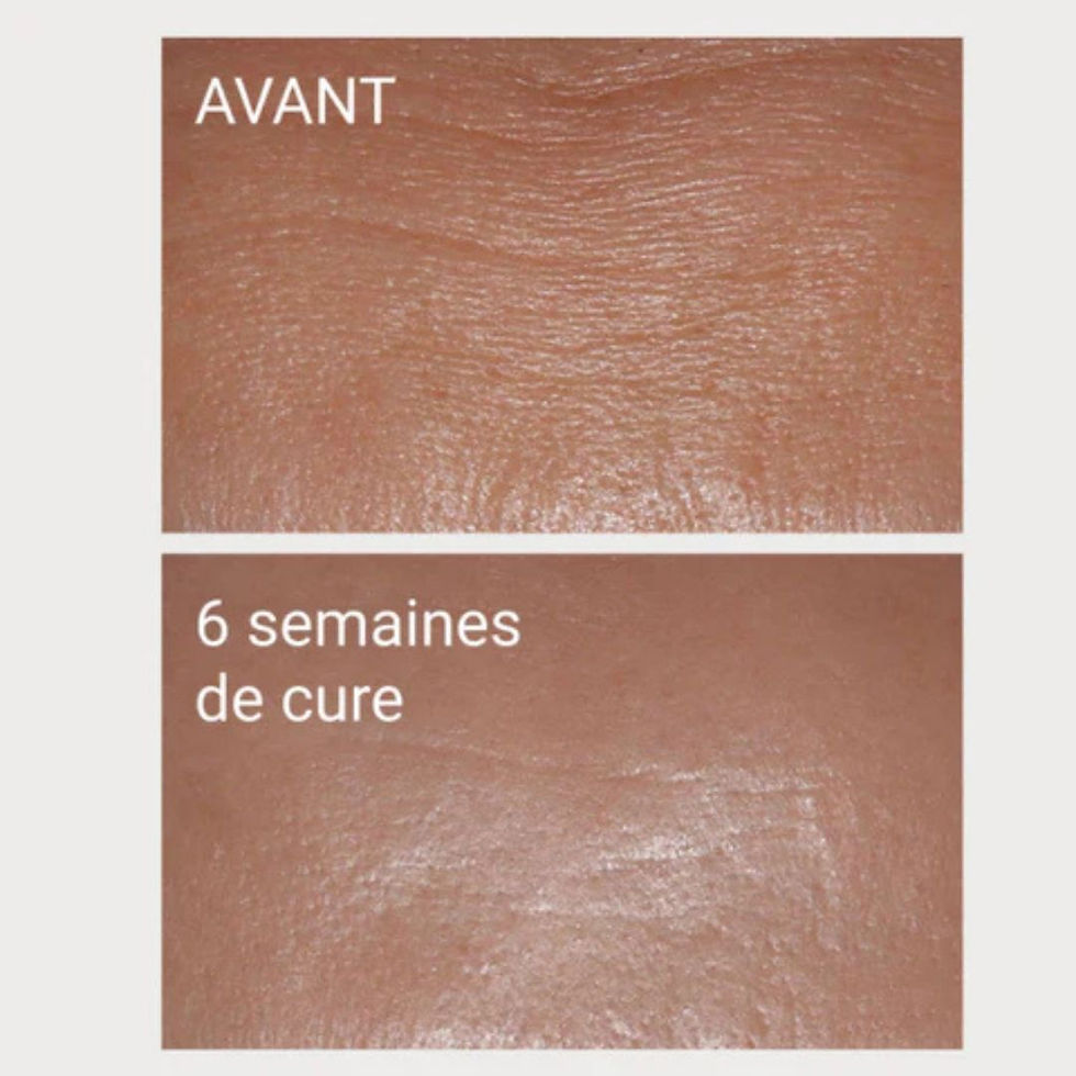 Miniature : NOVEXPERT Collagène complément alimentaire anti-rides et fermeté
