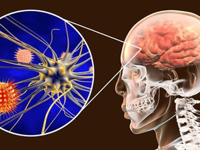 Meningitis