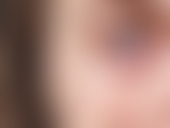 Aumentan los casos de conjuntivitis viral en las consultas oftalmológicas