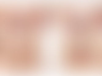 Infección urinaria en adultos