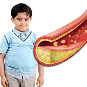 Colesterol alto en niños y adolescentes