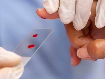 Estiman que más de 570 dominicanos viven con hemofilia
