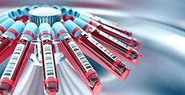 Análisis de sangre detecta 14 tipos de cáncer en fases tempranas