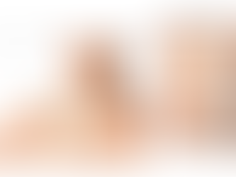 Tinea Versicolor (Troud Pityriasis Versicolor ): A Holistic Perspective on Mottled Skin