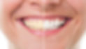 consejos-para-balnquear-tus-dientes.jpg