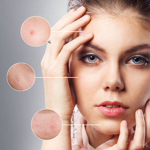 How to improve your skin naturally without over treating it