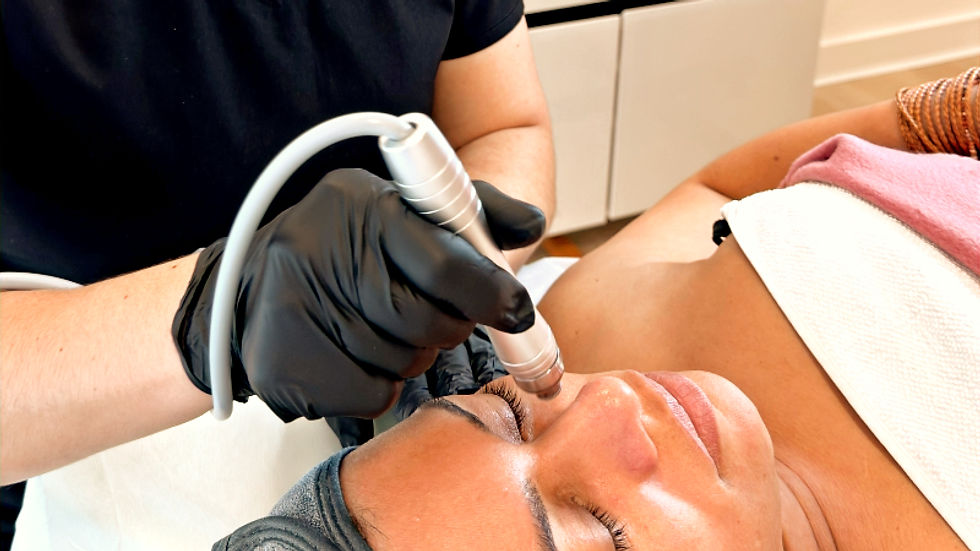 microdermabrasion treatment at Crissy skin therapy