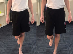 What is Hip Drop & How can I fix it?