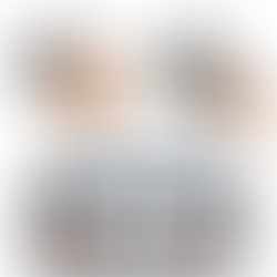 How OBD2 Helps Detect Ignition Timing Irregularities