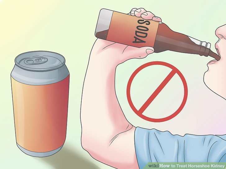 Is Soda Really Bad For Your Kidneys?