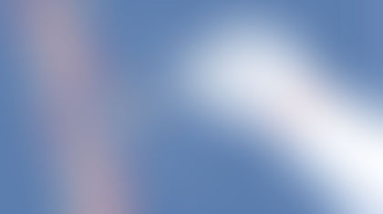 Locked Nucleic Acid (LNA) Teknolojisi: