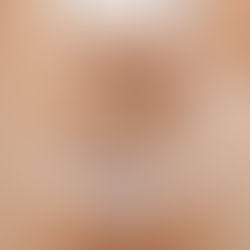 Cómo desintoxicar el colon naturalmente: guía holística para mejorar tu salud intestinal