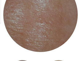 肌カメラというおもちゃにハマっております