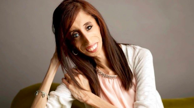 Lizzie Velásquez
