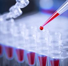 Blood Sample_edited.jpg