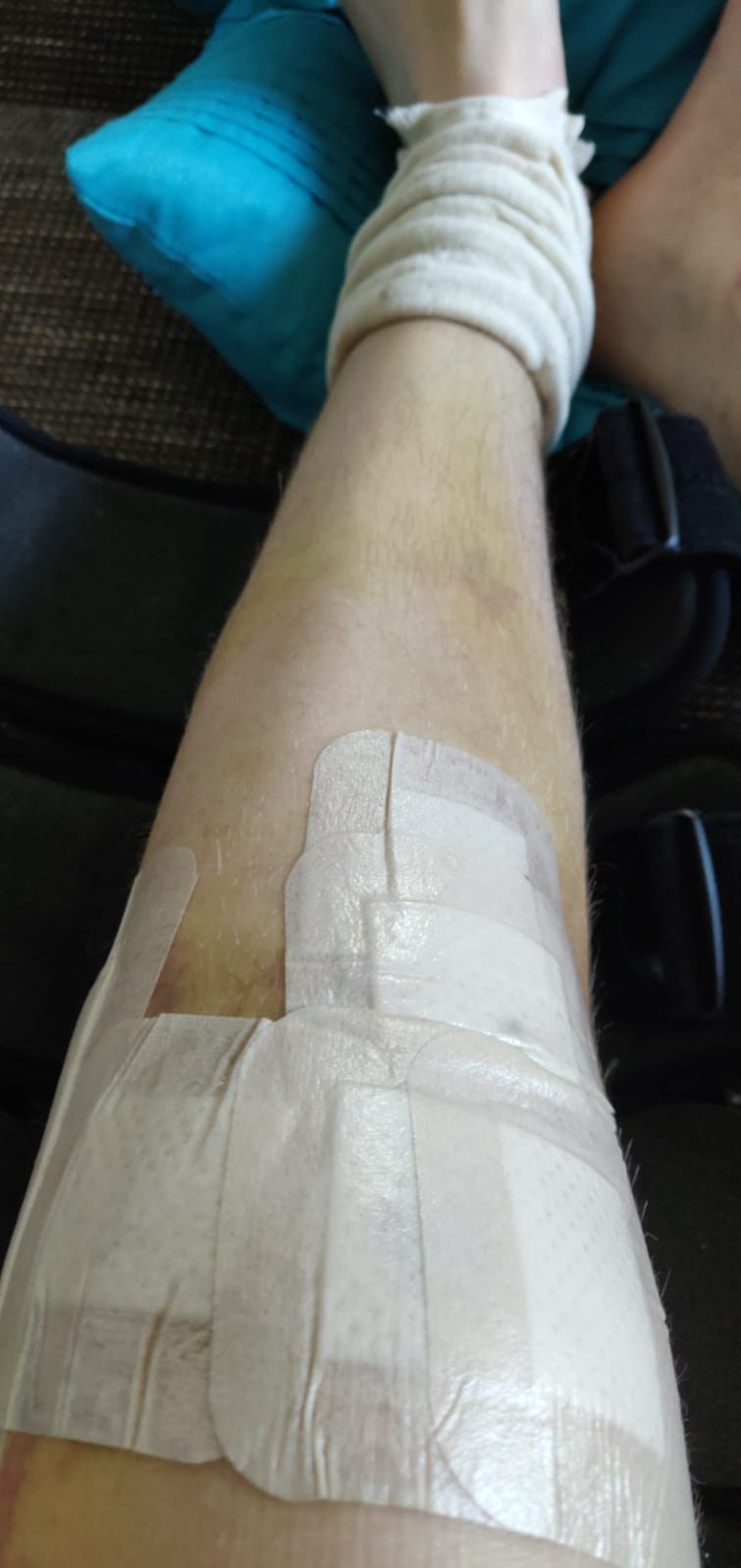 Kruisband operatie post operatief