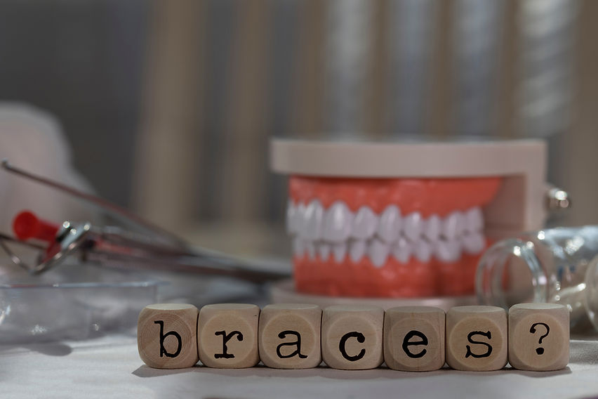 Orthodontic case presentation 