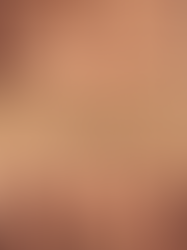 Can You Be Forgiven Without Being Excused?