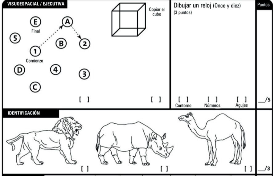 MoCA test. Montreal Cognitive Assessment