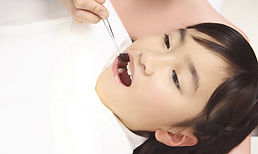 歯科治療中の子供