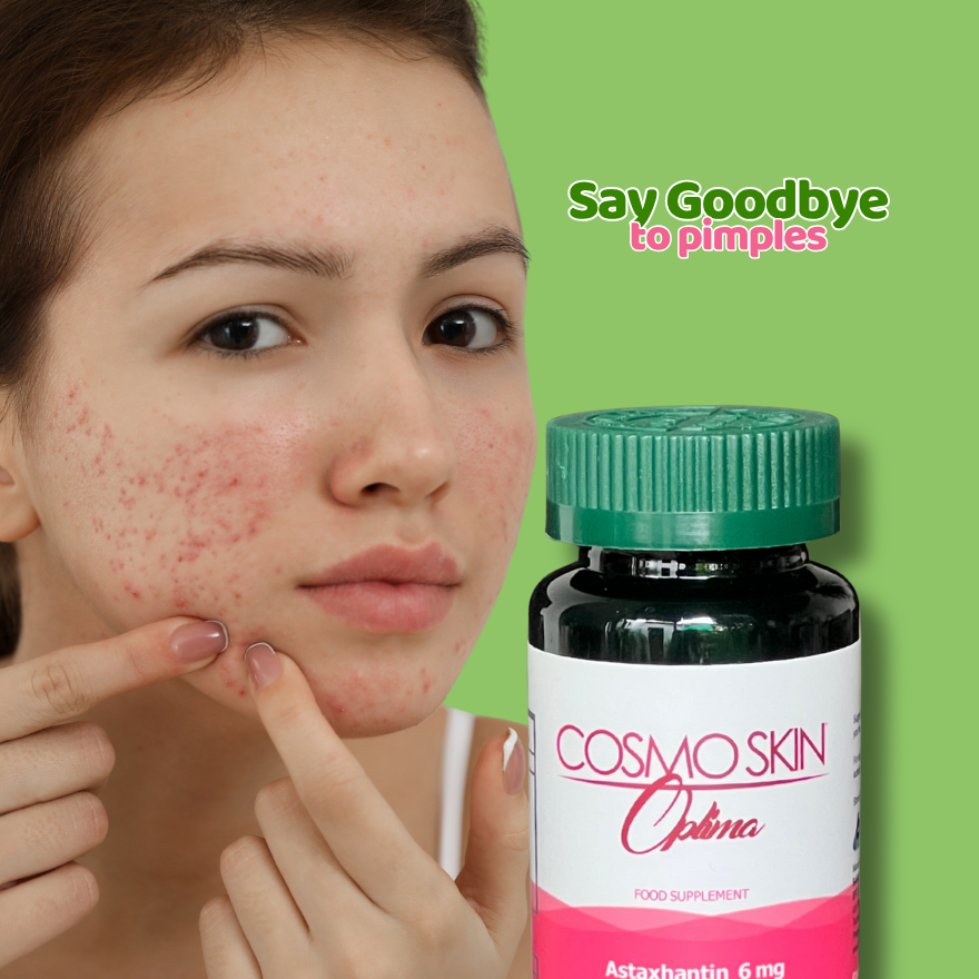Thumbnail: Melasma Plus Acne Silver Promo Pack