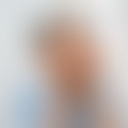 When Will My Wrinkle Smoothing Injections Start Working?