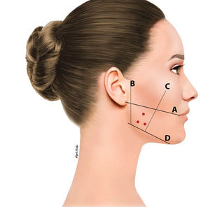 Bruxism & TMJ Injection Treatments