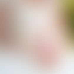 Wedding Anti-Wrinkle advice Pre Wedding Cosmetic Injectables Advice