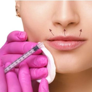 Lip Flip Treatment Explained