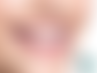 Diş Teli Mi, Şeffaf Plak Mı?