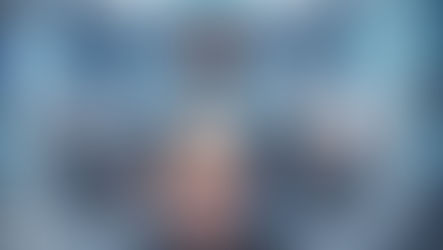 "Bana İmplant Olmaz" Demeyin! Gelişmiş İmplant Teknikleri ile Sabit Dişlere Kavuşun