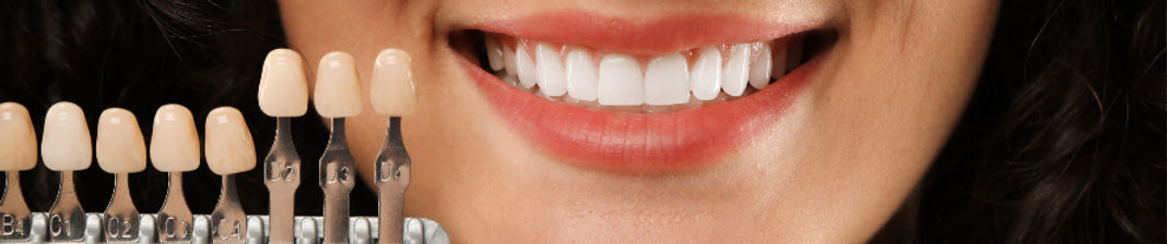 Porselen Lamine Kaplama Diş, Yaprak Porselen, ayrık dişler, kırık dişler, şekli bozuk dişlerin düzeltilmesinde kullanılır