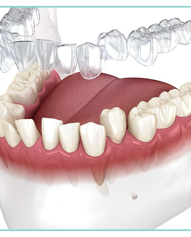 vien denta ağız ve diş sağlığı merkezi ortodonti hakkında