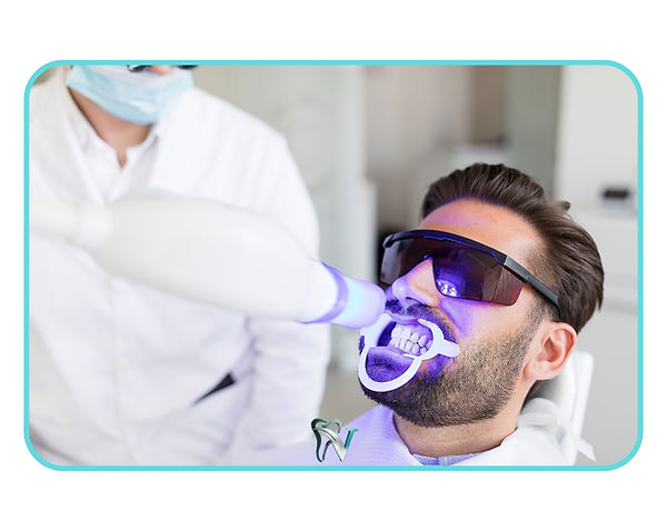 Strahlend lächelnde Münder durch Zahnaufhellung