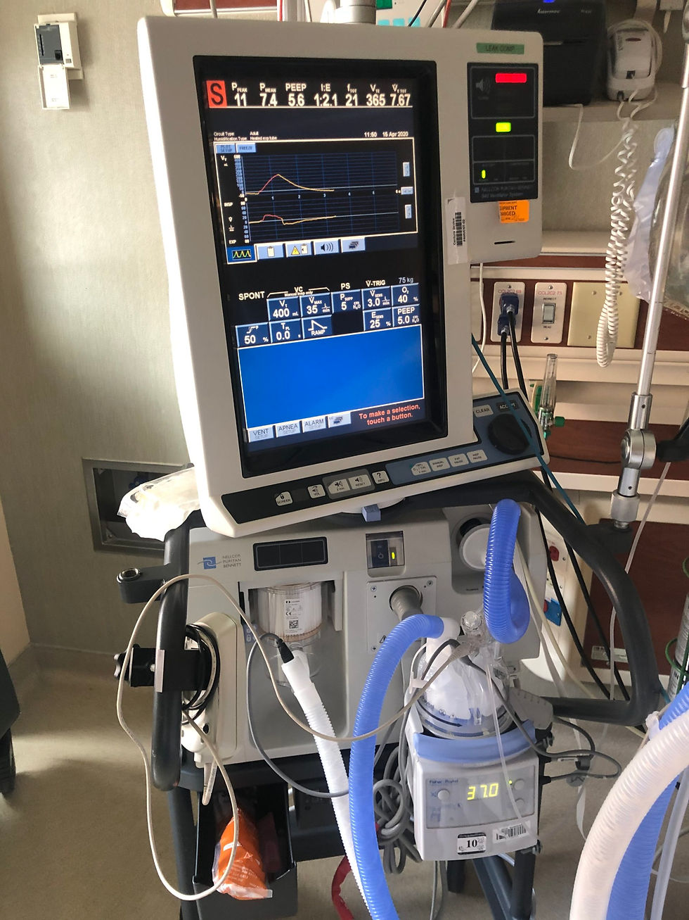 Ventilator2.jpg