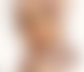 Real-Life Experiences: Success Stories and Testimonials from Laser Hair Removal Patients